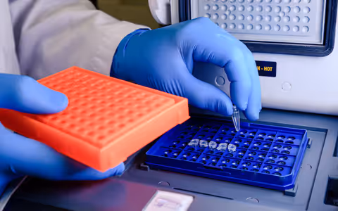Laboratory Chromatographs Explained: Types, Techniques, and Analytical Applications