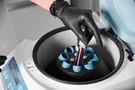 Plasma Dialysis Treatments Overview: Essential Facts, Medical Applications, and Patient Care